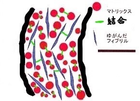 縮毛構造
