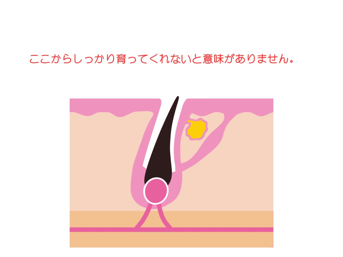 毛髪の成長の始まり